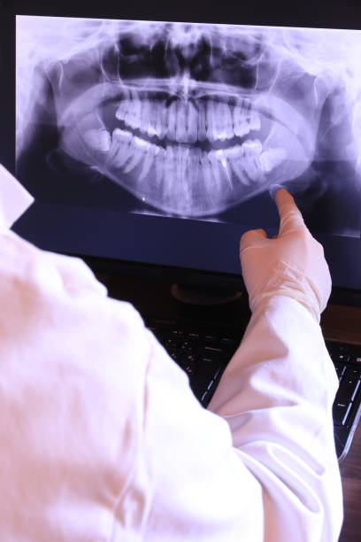 Best Emergency Tooth Extraction in Channelview, TX